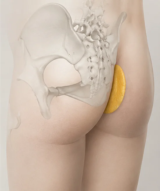 자가 진피·진피지방 DERMAL 안내 이미지