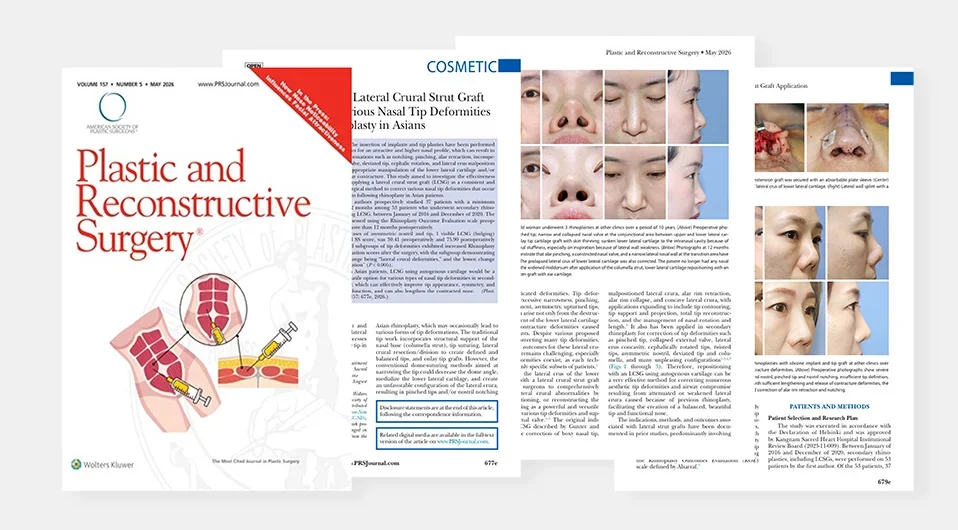 Versatile Usability of Lateral Crural Strut Graft for Correction of Various Nasal Tip Deformities in Secondary Rhinoplasty in Asians