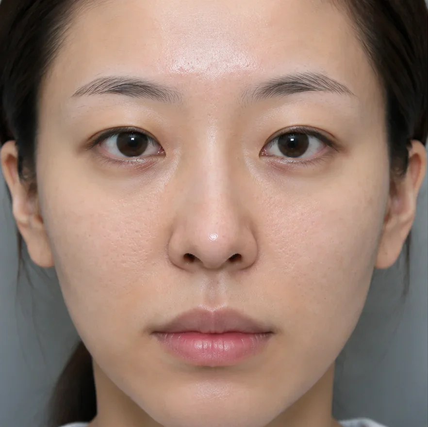 코가 예뻐지지않고 더 이상함
